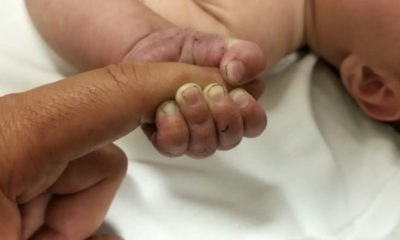 Photo of baby with dirty fingernails