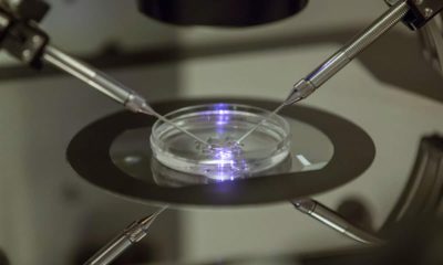 Photo of vitro fertilization